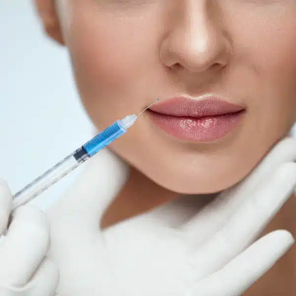 Le visage d'une femme recevant une injection d'acide hyaluronique, administrée par un médecin avec une seringue.