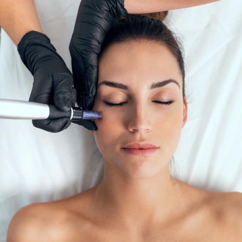 Séance de mésothérapie visage - Une cliente détendue profite d'une séance de mésothérapie pour le visage, une technique de pointe offerte par la clinique Dr Djoon pour revitaliser et rajeunir la peau.