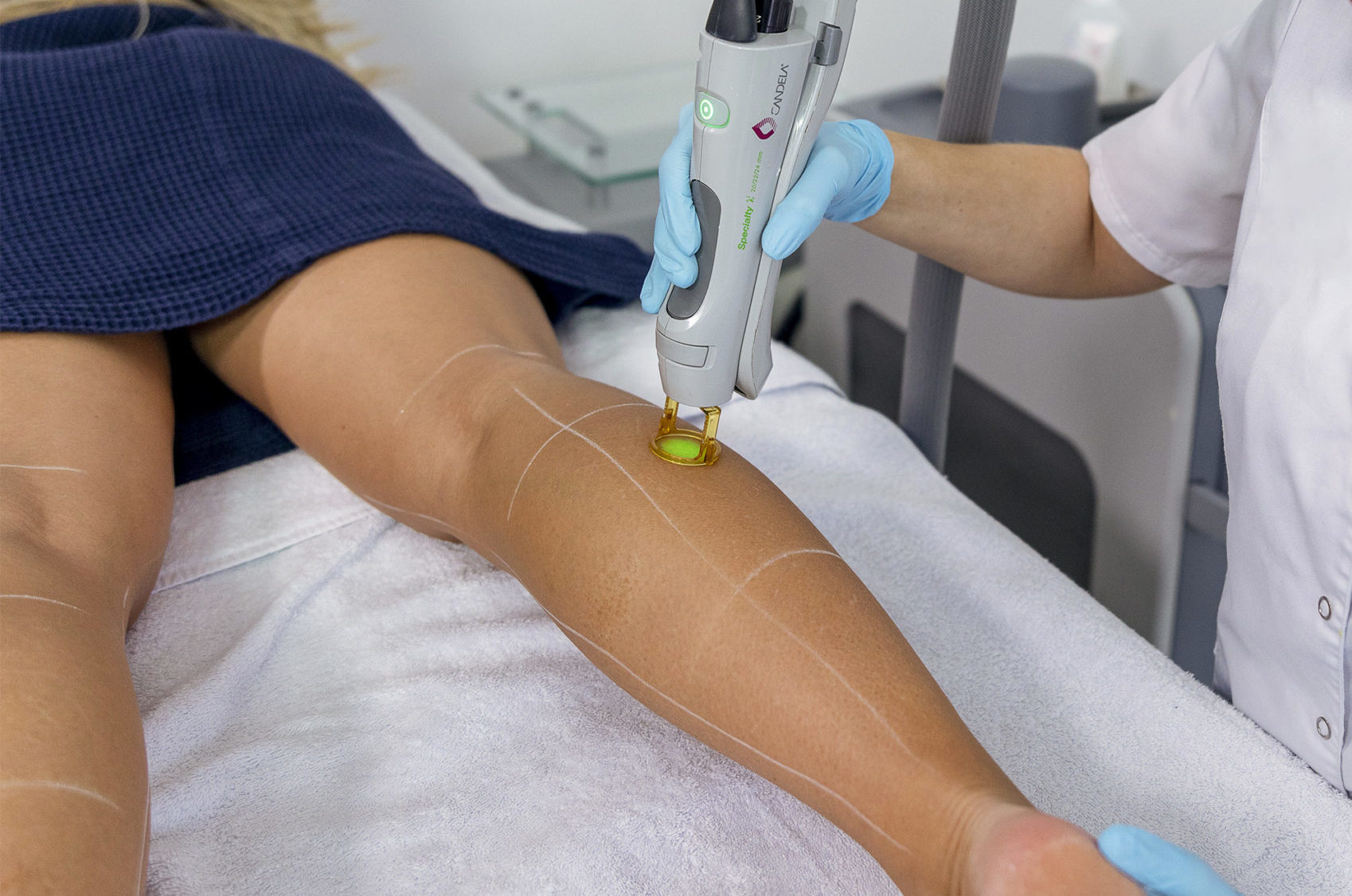 Une femme reçoit une séance d'épilation laser sur ses mollets à la clinique Dr Djoon à Genève.