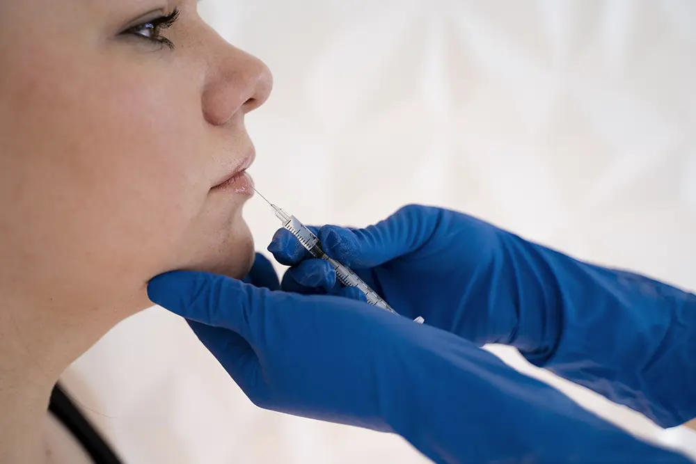 Acide-hyaluronique-geneve-Femme jeune injection vue de côté