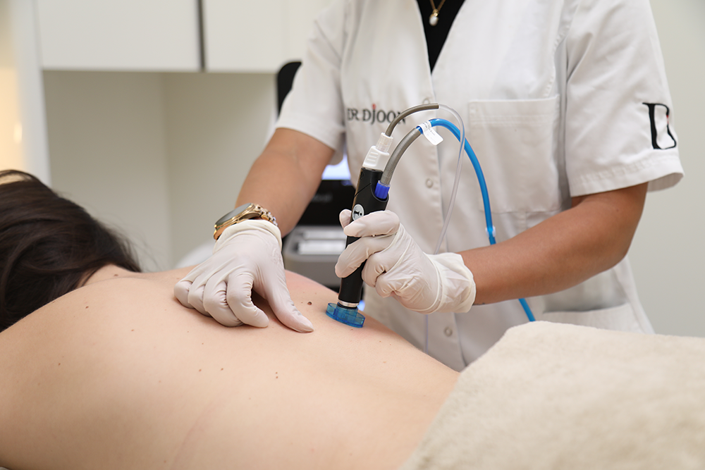 hydrafacial-geneve-1