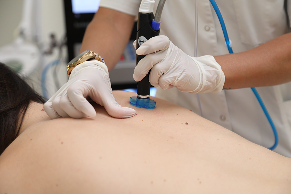 hydrafacial-geneve-2