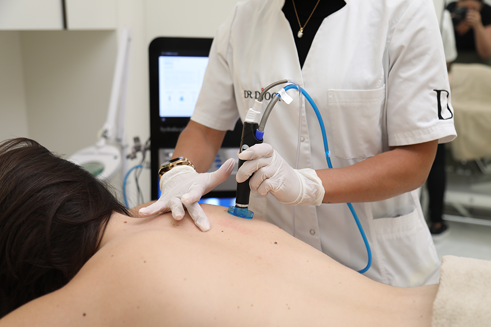 hydrafacial-geneve-3