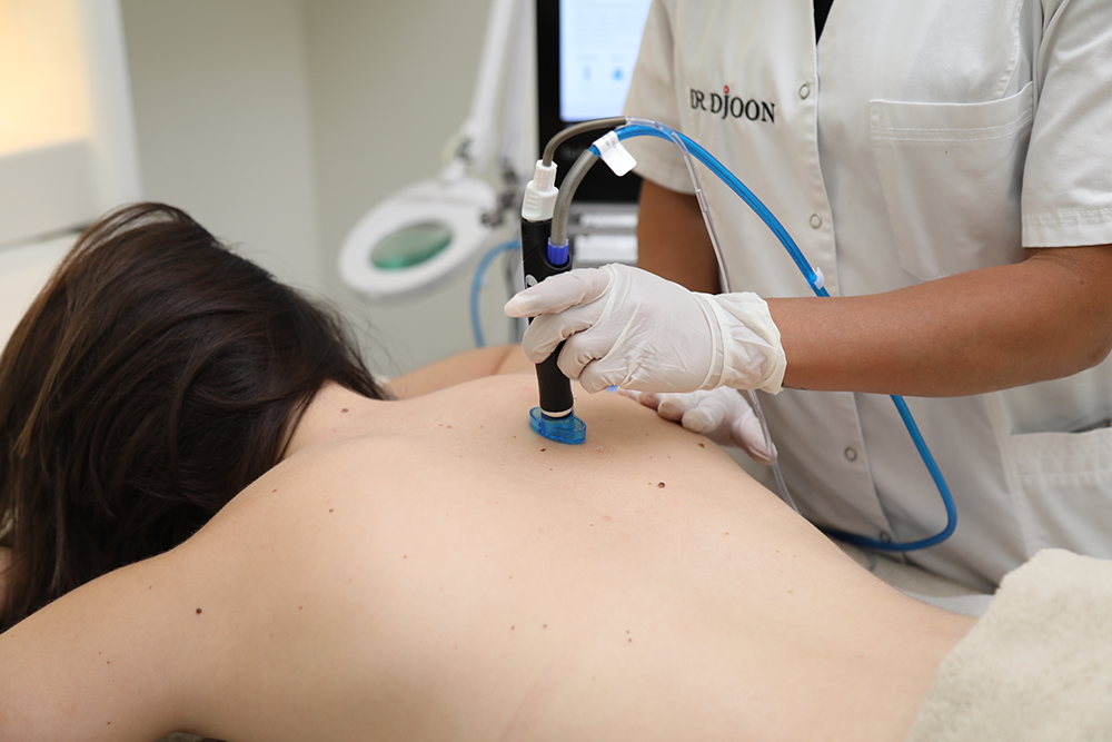 hydrafacial-geneve-4