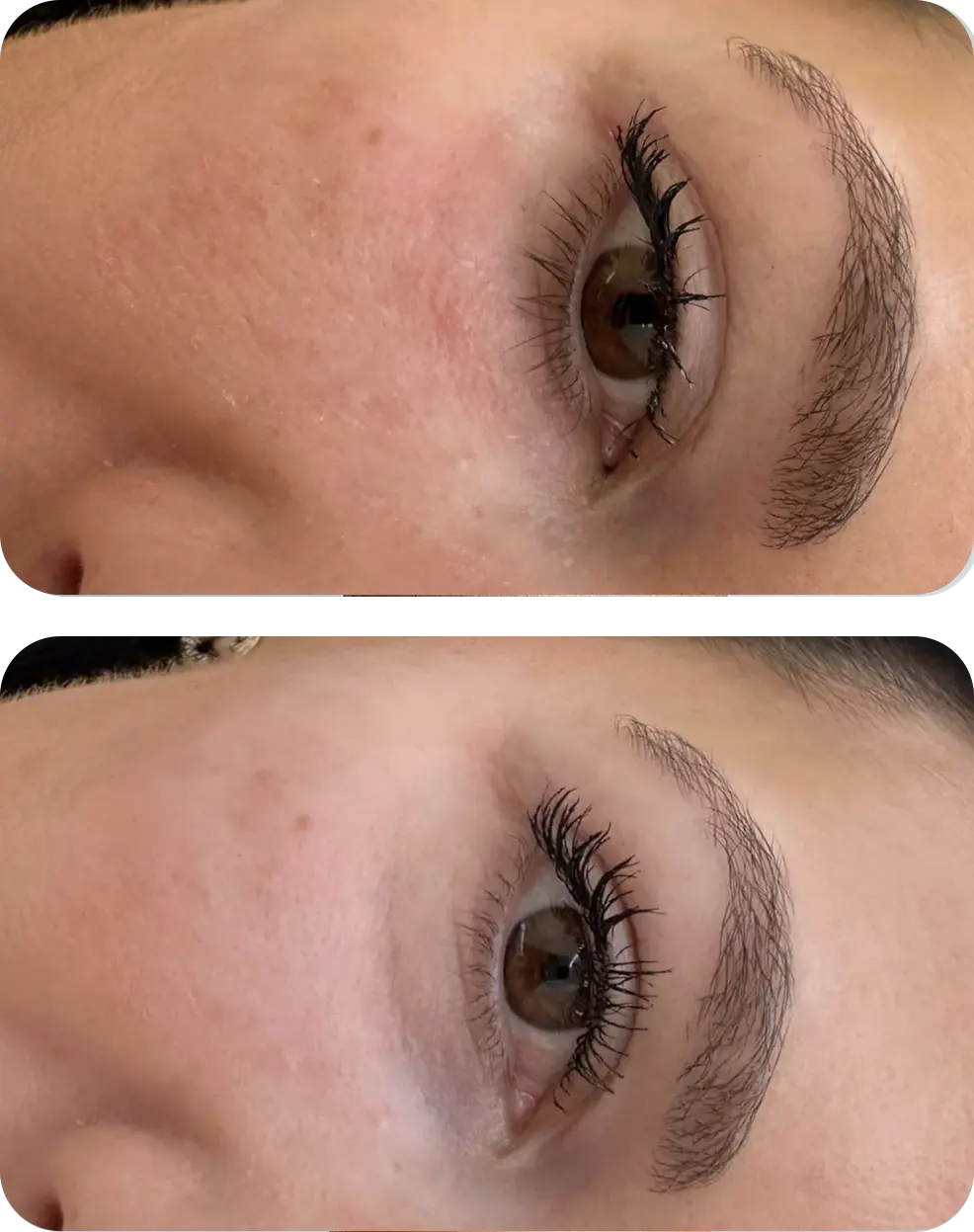 hydrafacial-resultat-mobile