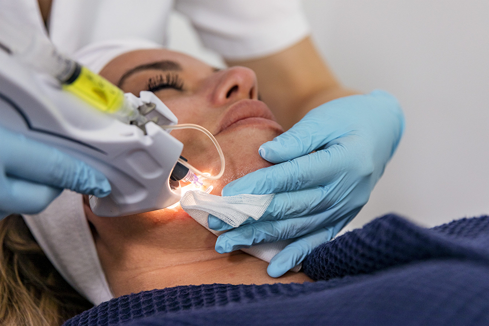 mesotherapie-geneve-2