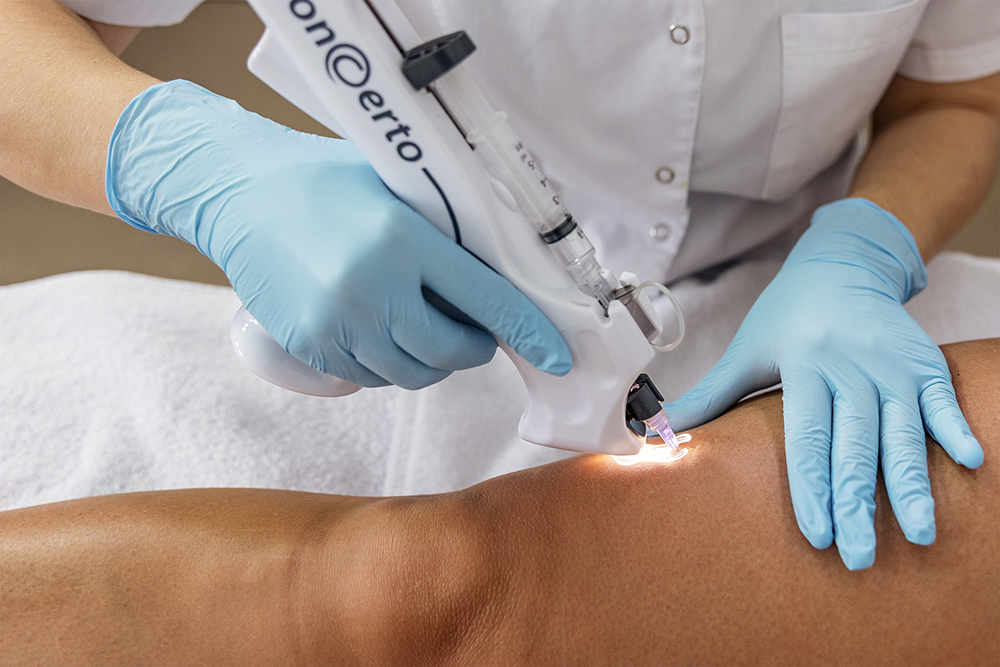 mesotherapie-geneve-3