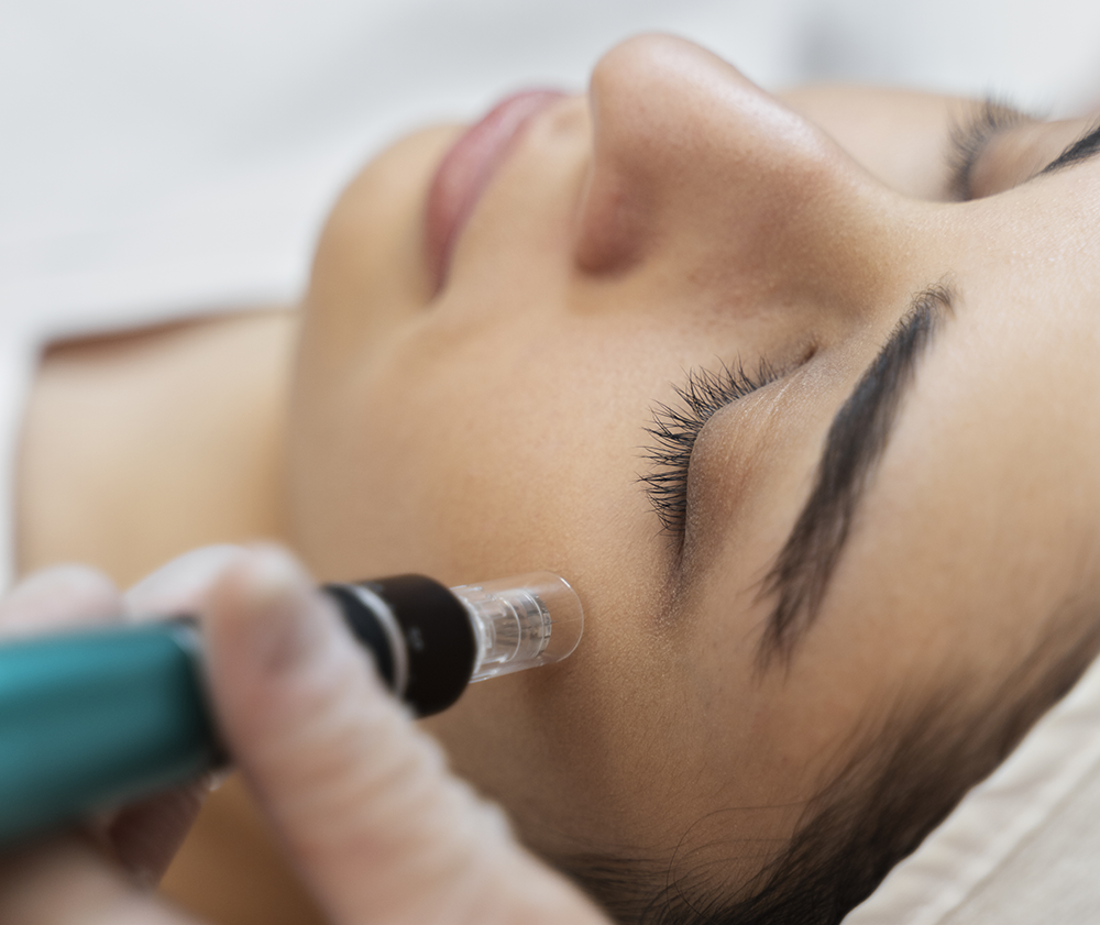 mesotherapie-geneve-4