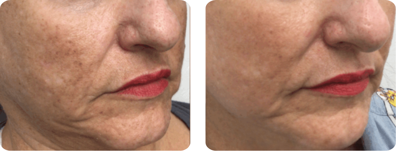 galeries site web (420 x 297 mm)