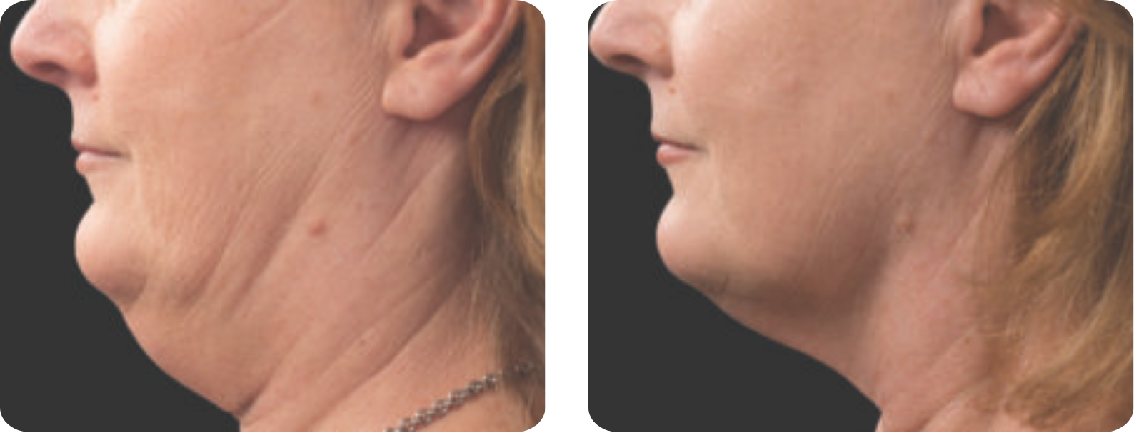 galeries site web (420 x 297 mm)-2