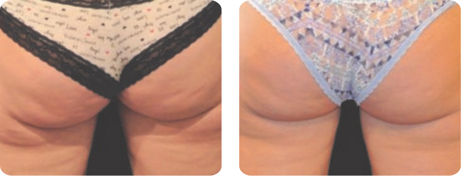 galeries site web (420 x 297 mm)-4