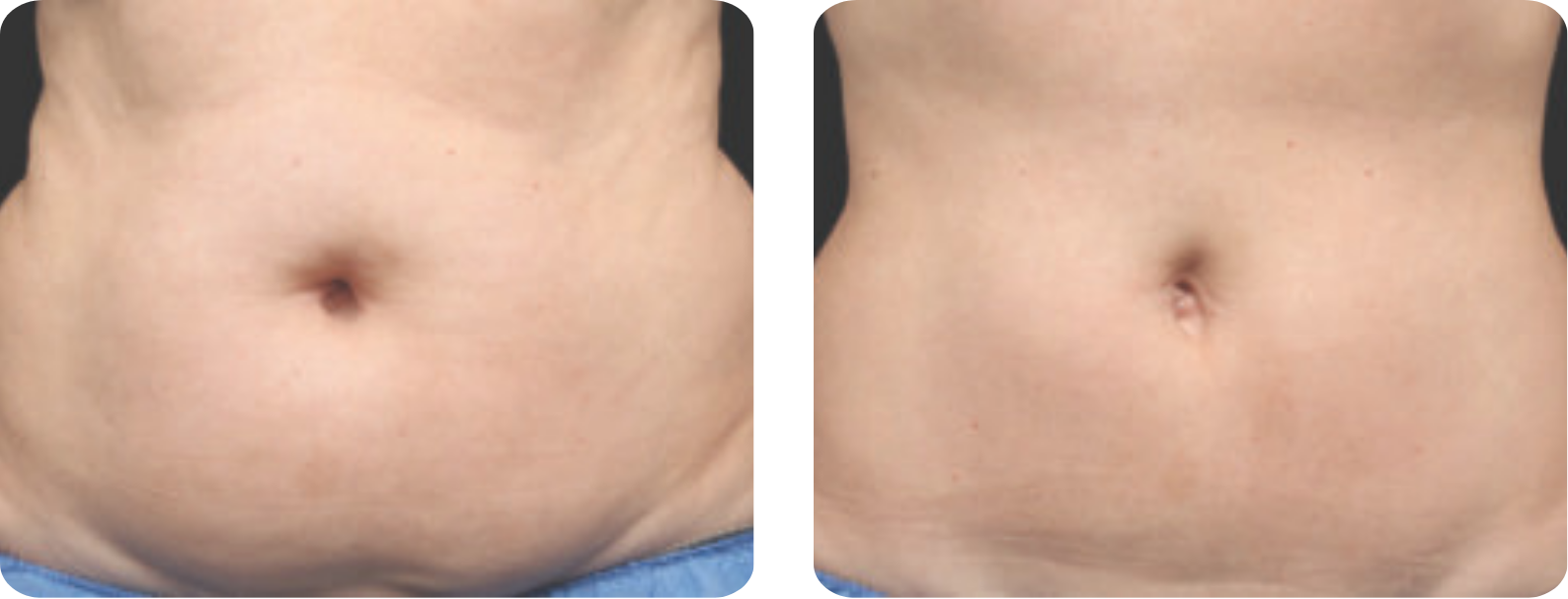 galeries site web (420 x 297 mm)-5