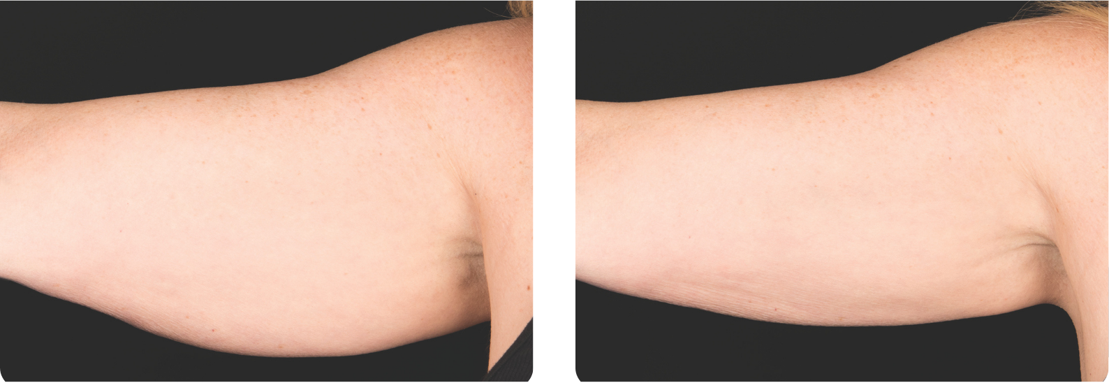 Modèle Galerie SiteWeb