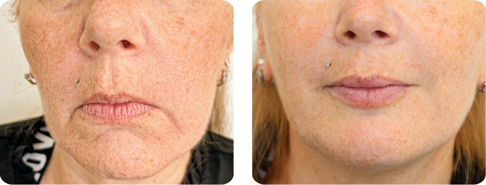 Modèle Galerie SiteWeb