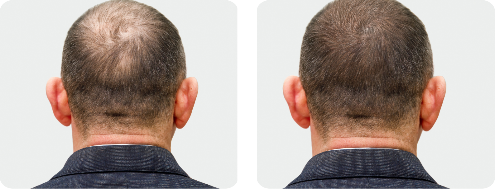 Modèle Galerie SiteWeb