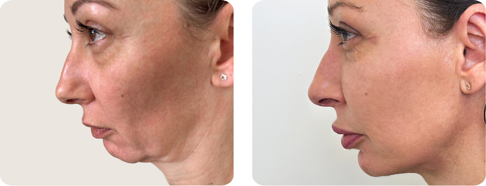 Modèle Galerie SiteWeb -10