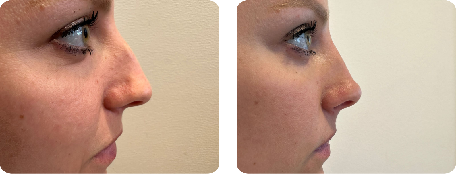 Modèle Galerie SiteWeb -2