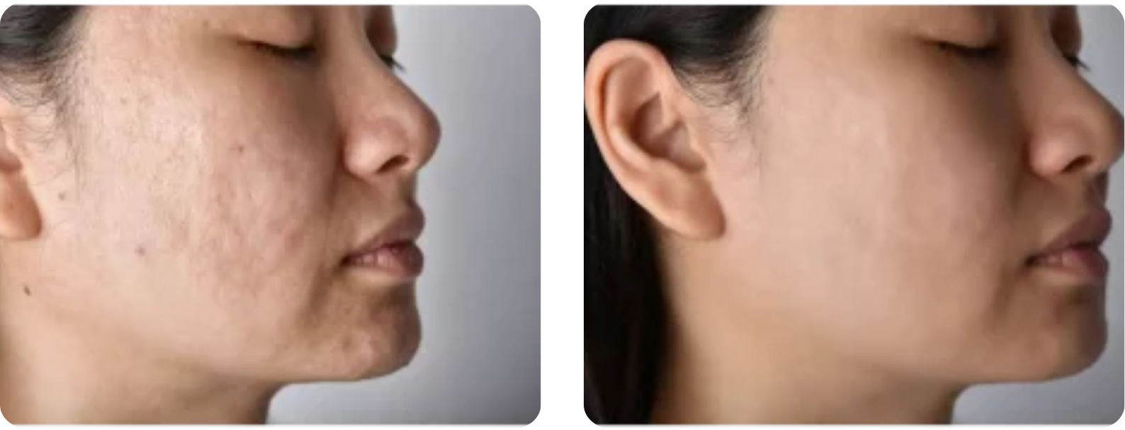 Modèle Galerie SiteWeb -2