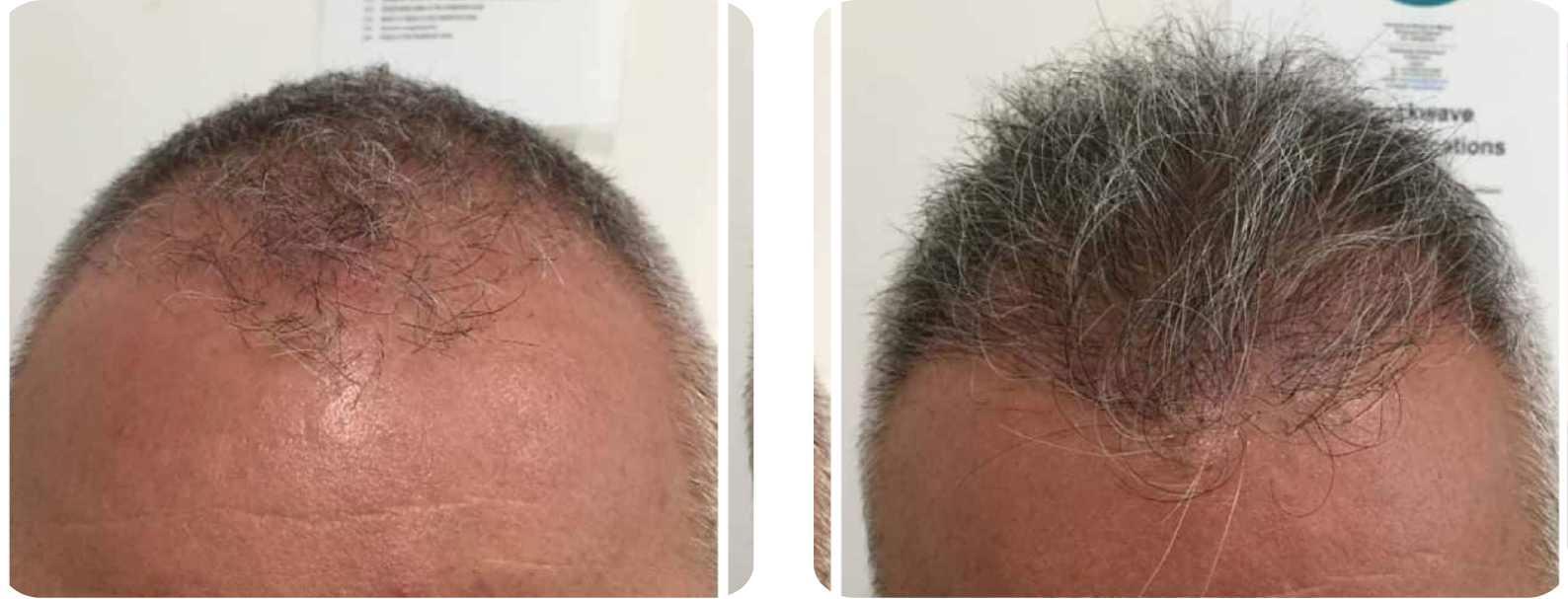 Modèle Galerie SiteWeb -2 copie