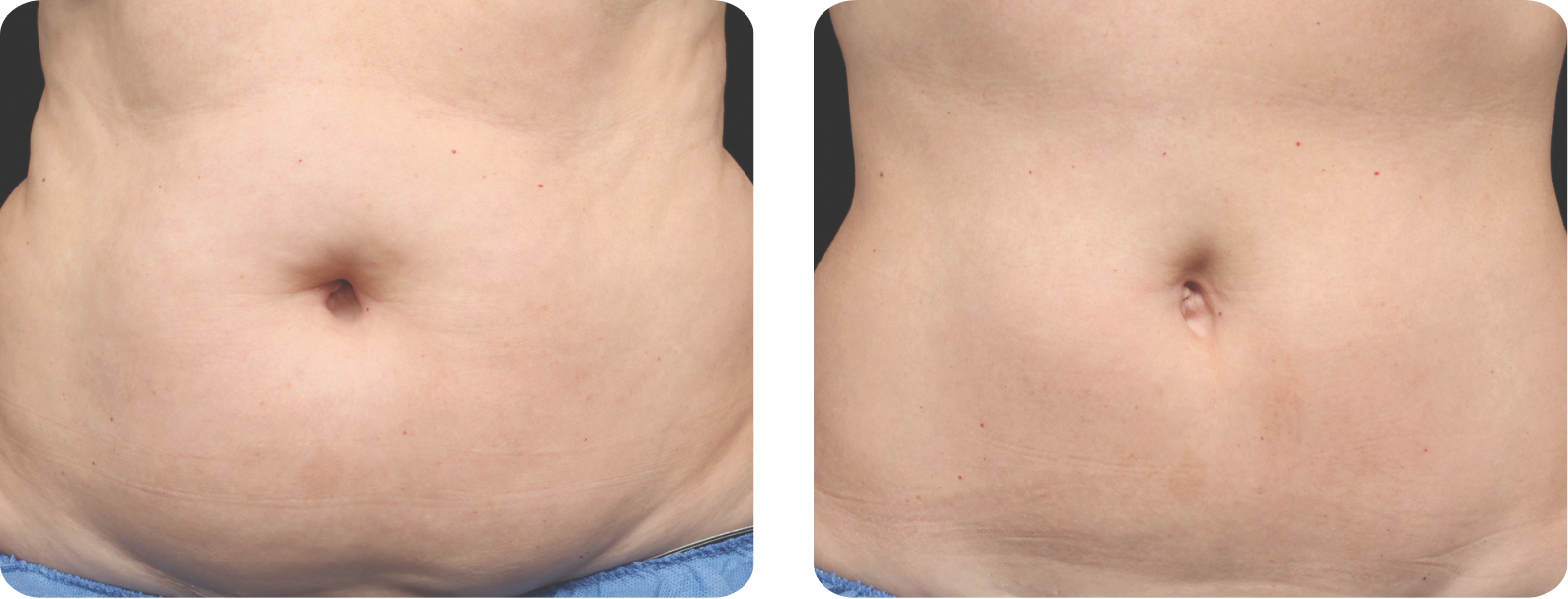 Modèle Galerie SiteWeb -2