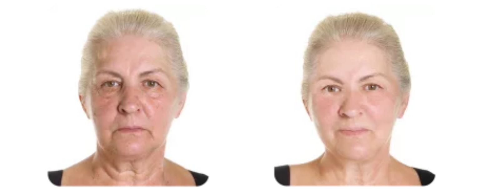 Modèle Galerie SiteWeb -3