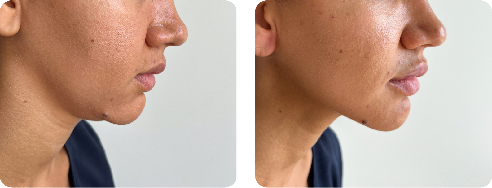 Modèle Galerie SiteWeb -3