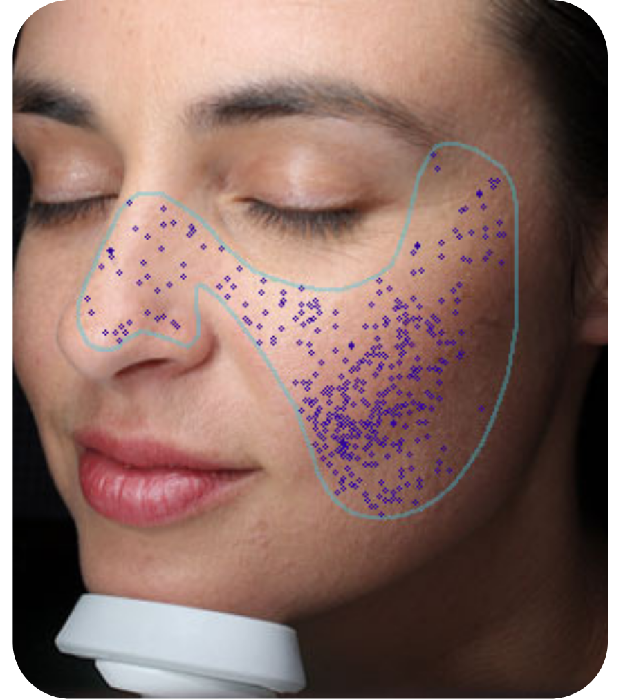 PORES