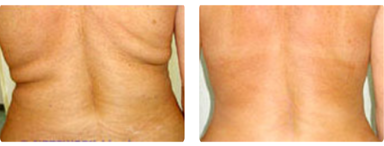 Modèle Galerie SiteWeb -4