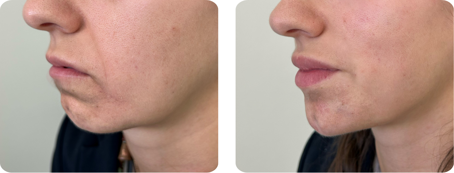 Modèle Galerie SiteWeb -4