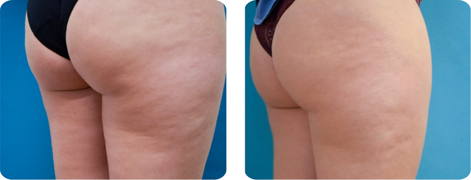 Modèle Galerie SiteWeb -5