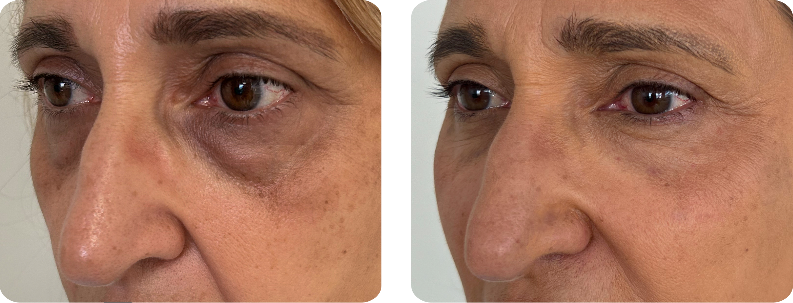 Modèle Galerie SiteWeb -5