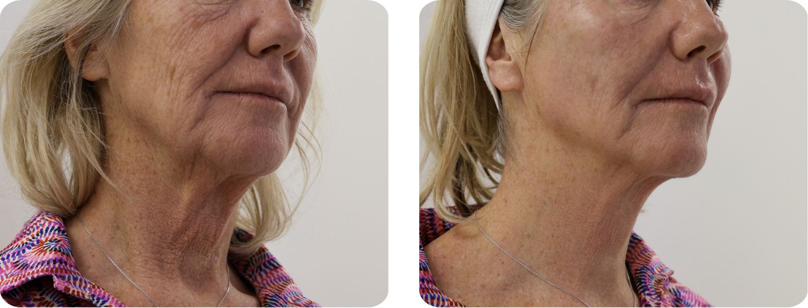 Modèle Galerie SiteWeb -6