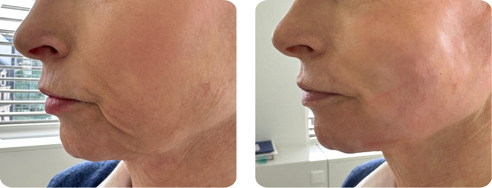 Modèle Galerie SiteWeb -7