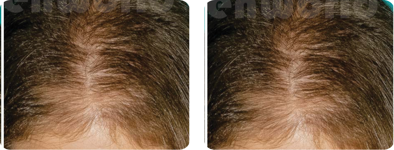 Modèle Galerie SiteWeb copie 2