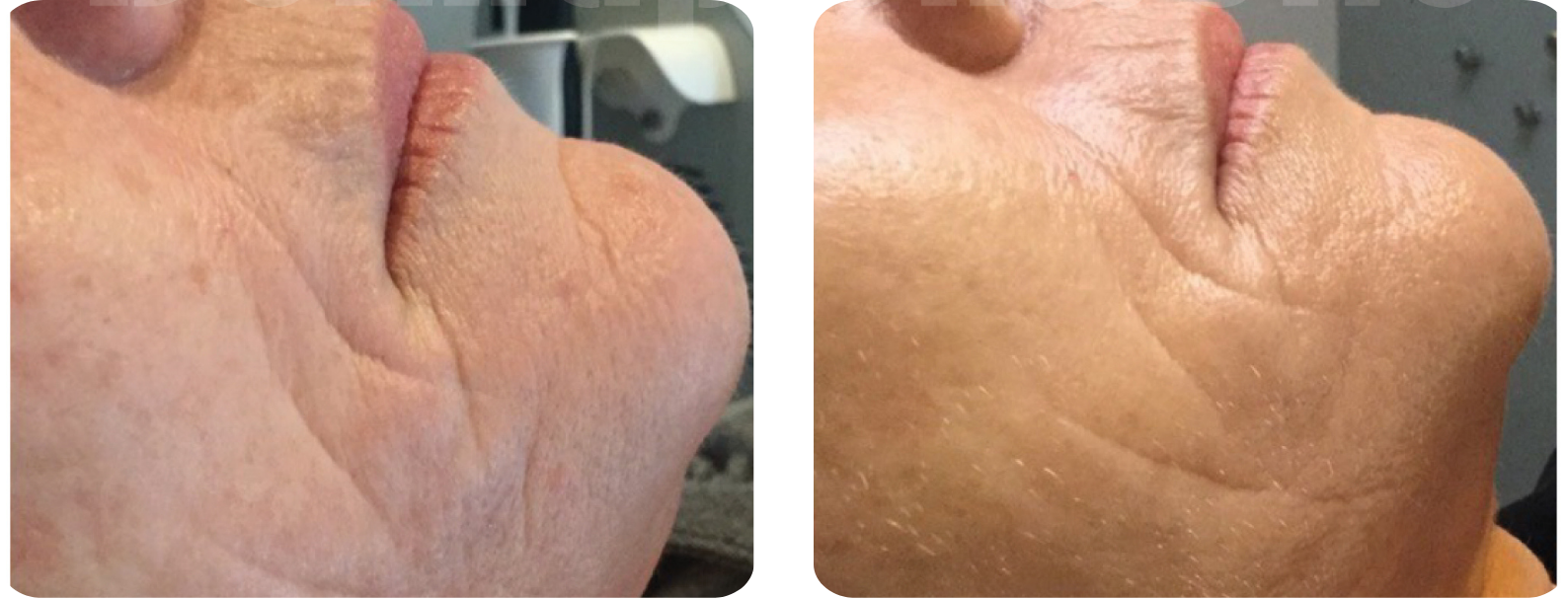 Modèle Galerie SiteWeb copie