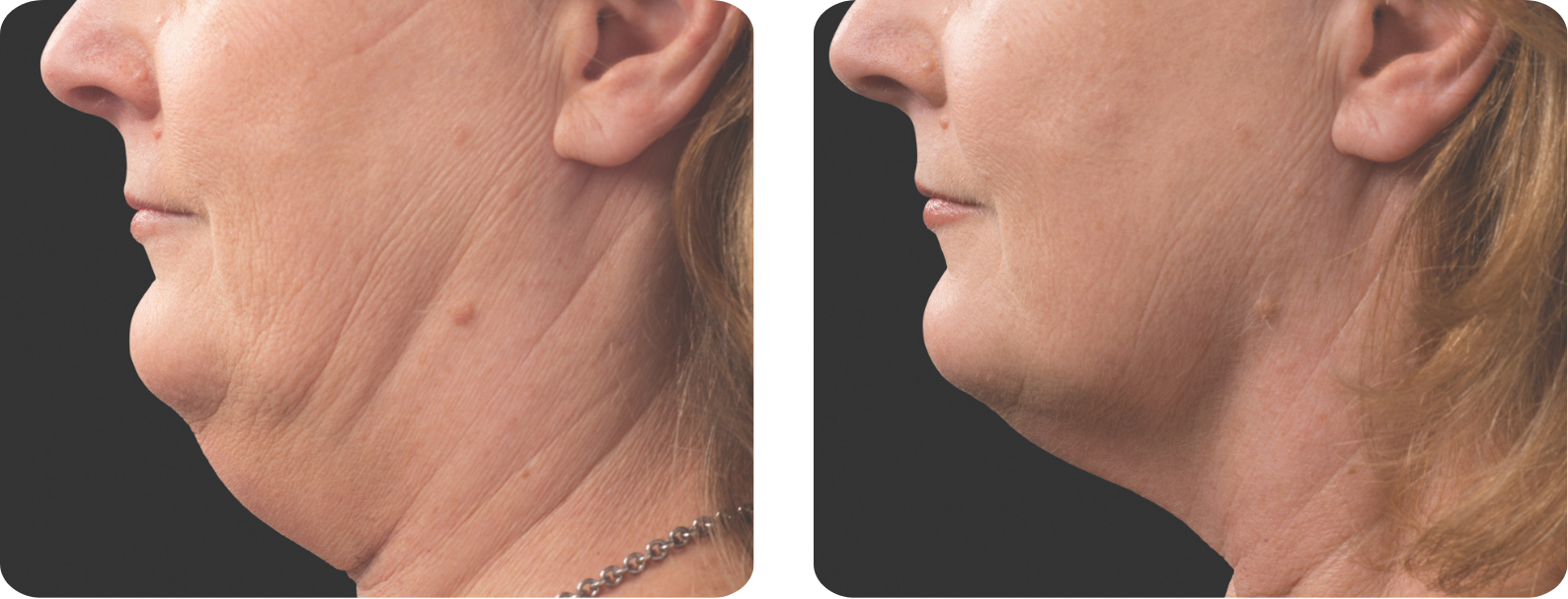 Modèle Galerie SiteWeb copie