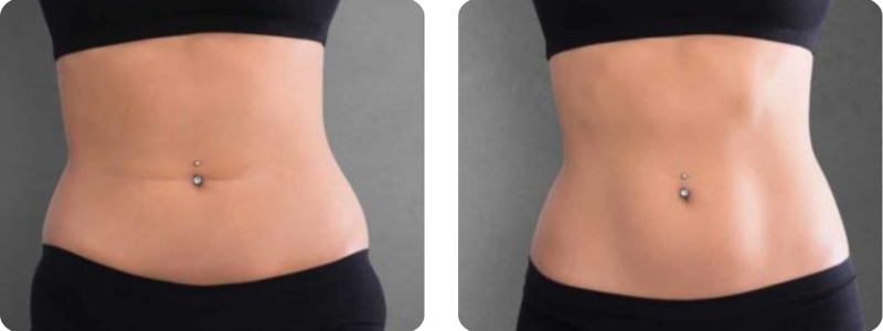 galeries site web (420 x 297 mm)-2