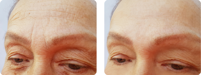 galeries site web (420 x 297 mm)-2