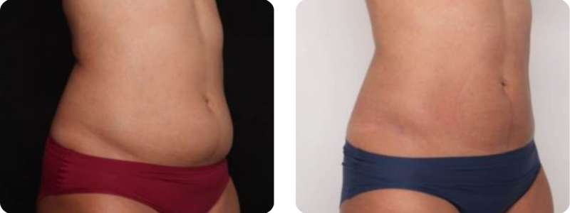 galeries site web (420 x 297 mm)-4