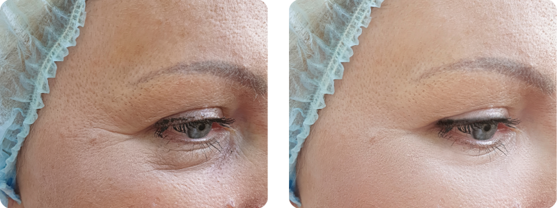 galeries site web (420 x 297 mm) copie